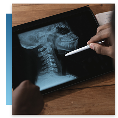 doctor examining xray image